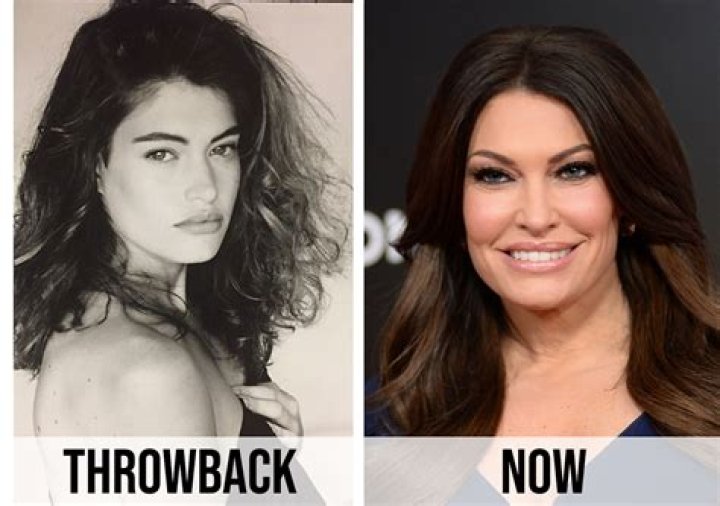 Kimberly Guilfoyle's Transformation: Before And After Plastic Surgery