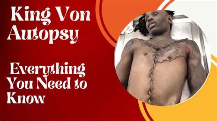 The Autopsy Of King Von: Unraveling The Mystery Behind His Death