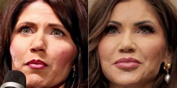 Unveiling The Truth: Did Kristi Noem Have Plastic Surgery?