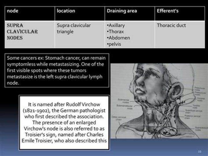 What You Need To Know About Swollen Virchow's Node Cancer